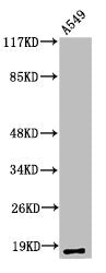 Western Blot analysis of A549 cells using Cleaved-MMP-1 22k (F100) Polyclonal Antibody