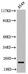 Western Blot analysis of A549 cells using Cleaved-PARP-1 (D214) Polyclonal Antibody