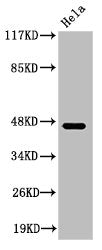 Western Blot analysis of HeLa cells using Cleaved-Plasma Kallikrein HC (R390) Polyclonal Antibody