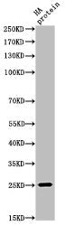 Western Blot analysis of HA-protein cells using HA-tag Polyclonal Antibody