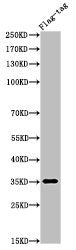 Western Blot analysis of FLAG-tag cells using FLAG-tag Polyclonal Antibody