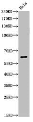 Western Blot analysis of Hela cells using Acetyl-NFκB-p65 (K310) Polyclonal Antibody