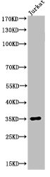 Western Blot analysis of JK cells using Acetyl-Ref-1 (K7) Polyclonal Antibody