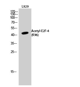 Western Blot analysis of L929 cells using Acetyl-E2F-4 (K96) Polyclonal Antibody