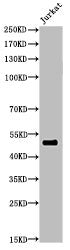 Western Blot analysis of JK cells using Acetyl-HNF-3α/β/γ(K264/253/211) Polyclonal Antibody