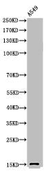 Western Blot analysis of A549 cells using Acetyl-Histone H2B (K126) Polyclonal Antibody