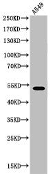 Western Blot analysis of A549 cells using Acetyl-Cytokeratin 8 (K483) Polyclonal Antibody