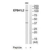 Western blot analysis of extracts from HuvEc cells and HeLa cells, using PPP2R5A antibody.