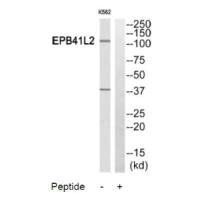 Western blot analysis of extracts from HuvEc cells and HeLa cells, using PPP2R5A antibody.
