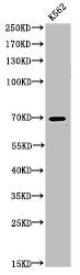 Western Blot analysis of K562 cells using Acetyl-p73 (K321) Polyclonal Antibody