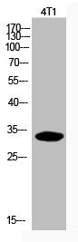 Western Blot analysis of 4T1 cells using Acetyl-p57 (K278) Polyclonal Antibody