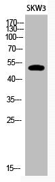 Western Blot analysis of SKW3 cells using Acetyl-p53 (K320) Polyclonal Antibody
