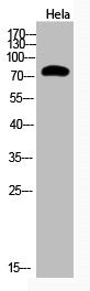 Western Blot analysis of Hela cells using Acetyl-Ub (K48) Polyclonal Antibody