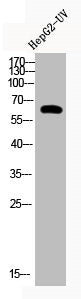 Western Blot analysis of HEPG2-UV cells using Acetyl-Cortactin (K235) Polyclonal Antibody