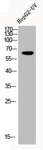 Western Blot analysis of HEPG2-UV cells using Acetyl-NFκB-p65 (K122) Polyclonal Antibody