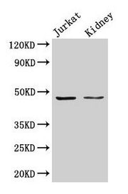 Western Blot Positive WB detected in: Jurkat whole cell lysate, Rat kidney tissue All lanes: ALDOA antibody at 3µg/ml Secondary Goat polyclonal to rabbit IgG at 1/50000 dilution Predicted band size: 40, 46 kDa Observed band size: 46 kDa