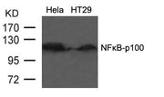 Western blot analysis of extracts from HT29 cells using NFkB-p100(Ab-866) Antibody.