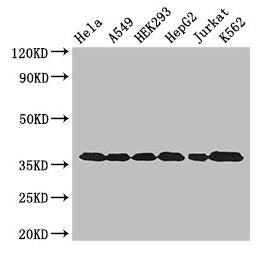 Western Blot Positive WB detected in: Hela whole cell lysate, A549 whole cell lysate, HEK293 whole cell lysate, HepG2 whole cell lysate, Jurkat whole cell lysate, K562 whole cell lysate All lanes: GAPDH antibody at 3µg/ml Secondary Goat polyclonal...