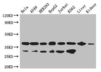 Western Blot Positive WB detected in: Hela whole cell lysate, A549 whole cell lysate, HEK293 whole cell lysate, HepG2 whole cell lysate, Jurkat whole cell lysate, K562 whole cell lysate, Mouse liver tissue, Mouse kidney tissue All lanes: GAPDH ant...