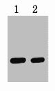 2ug HA fusion protein+ Primary antibody dilution at 1) 1:5000 2) 1:10000