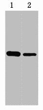 0.5ug GST fusion protein+ Primary antibody dilution at 1) 1:5000 2) 1:10000