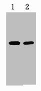 2ug RFP fusion protein+ Primary antibody dilution at 1) 1:5000 2) 1:10000