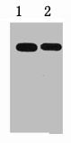 1ug MBP fusion protein+ Primary antibody dilution at 1) 1:5000 2) 1:10000