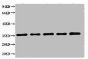 Western blot analysis of 293T (1), Rat brain (2), NIH 3T3 (3), Sheep Muscle (4), Rabbit testis (5), diluted at 1:20000.