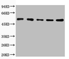 Western blot analysis of 1) Mouse skeletal muscle tissue, 2) Mouse kidney tissue, 3) Mouse Heart Tissue, 4) Mouse brain tissue, 5) Mouse Liver tissue, diluted at 1:2000.
