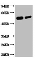 Western blot analysis of Hela, diluted at 1) 1:2000 2) 1:5000