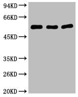 Western blot analysis of 1) Hela, 2) Mouse Brain, 3) HepG2, diluted at 1:2000.
