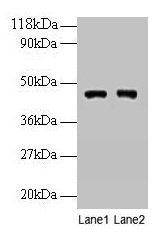 Western blot All lanes: PGK1 antibody at 2µg/ml Lane 1: EC109 whole cell lysate Lane 2: 293T whole cell lysate Secondary Goat polyclonal to rabbit IgG at 1/15000 dilution Predicted band size: 45, 42 kDa Observed band size: 45 kDa