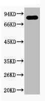 Western blot analysis of Hela, diluted at 1:1000.