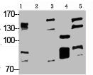 Western blot analysis of 1) Hela, 2) Jurkat, 3) HepG2, 4) Mouse Liver tissue, 5) Rat Brain tissue, diluted at 1:2000.