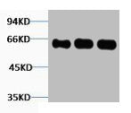 Western blot analysis of 1) Hela, 2) Mouse Brain, 3) Rat Brain tissue, diluted at 1:2000.