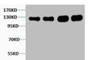 Western blot analysis of 1) Hela, 2) K562, 3) Mouse Brain, 4) Rat Brain tissue, diluted at 1:1000.