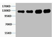 Western blot analysis of 1) Hela, 2) K562, 3) Mouse Brain, 4) Rat Brain tissue, diluted at 1:1000.