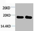 Western blot analysis of 1) Hela, 2) 3T3, diluted at 1:1000.