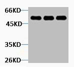 Western blot analysis of 1) Hela, 2) 3T3, 3) Rat Kidney tissue, diluted at 1:3000.