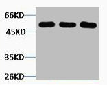 Western blot analysis of 1) Hela, 2) Mouse Brain, 3) Rat Brain tissue, diluted at 1:5000.