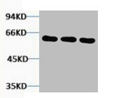 Western blot analysis of 1) Hela, 2) Mouse Brain, 3) Rat Brain tissue, diluted at 1:5000.