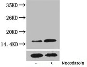 Western blot analysis of extracts from Hela cells, untreated (-) or treated, 1:2000.