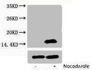 Western blot analysis of extracts from Hela cells, untreated (-) or treated, 1:2000.