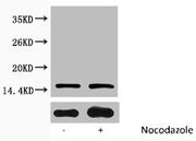 Western blot analysis of extracts from Hela cells, untreated (-) or treated, 1:2000.