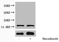 Western blot analysis of extracts from Hela cells, untreated (-) or treated, 1:2000.