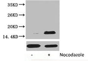 Western blot analysis of extracts from Hela cells, untreated (-) or treated, 1:2000