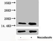 Western blot analysis of extracts from Hela cells, untreated (-) or treated, 1:2000.