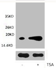 Western blot analysis of extracts from Hela cells, untreated (-) or treated, 1:2000.