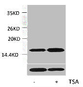 Western blot analysis of extracts from Hela cells, untreated (-) or treated, 1:2000.
