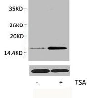 Western blot analysis of extracts from Hela cells, untreated (-) or treated, 1:2000.